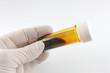 flasche jod mit hand