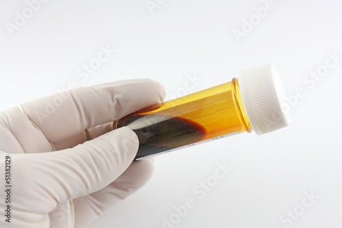 Photo: flasche jod mit hand flasche jod mit hand