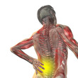 Conceptual human back pain anatomy