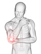 3d rendered medical illustration - painful elbow
