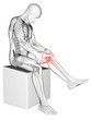 Illustration: 3d rendered medical illustration - painful knee 3d rendered medical illustration - painful knee