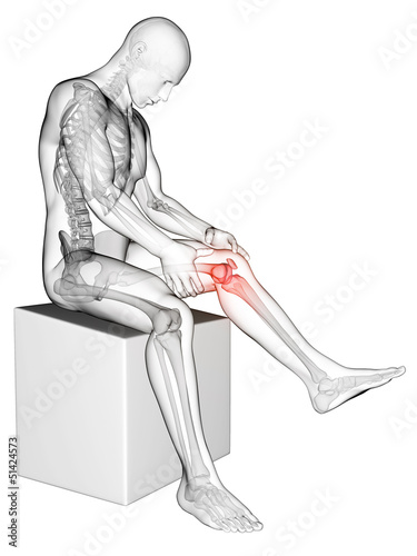 Illustration: 3d rendered medical illustration - painful knee 3d rendered medical illustration - painful knee