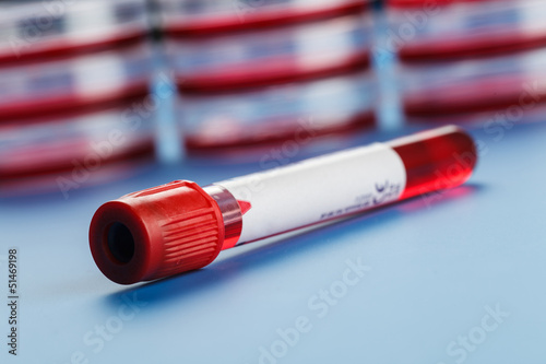 Photo: Blood sample Blood sample