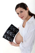 Pregnant woman with scan