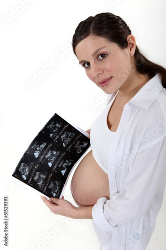 Photo: Pregnant woman with scan Pregnant woman with scan