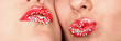 Lippen