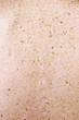 surface of the human skin