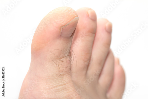 Photo: toes on a white background. macro toes on a white background. macro