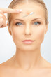 no more acne