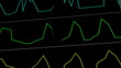 EKG ECG monitor extreme close up macro