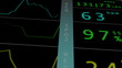 EKG ECG monitor extreme close up macro