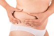 Woman showing her new stretch marks