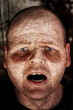 diseased man