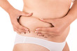 Woman showing her old stretch marks