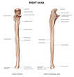 Ulna. Detailed medical illustration..