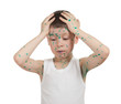 sick child. chickenpox