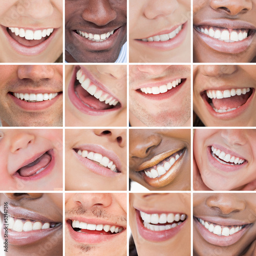 Photo: Collage of bright white smiles Collage of bright white smiles
