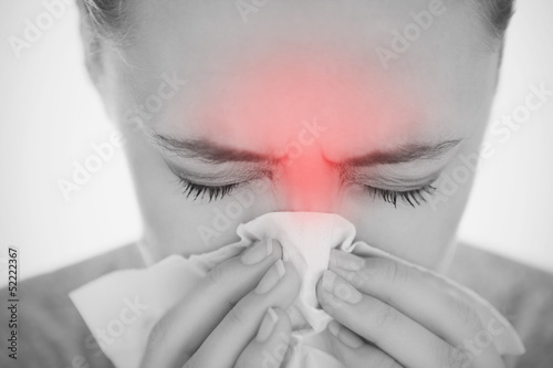 Photo: Woman blowing her nose with highlighted sinus pain Woman blowing her nose with highlighted sinus pain