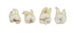 Extracted Wisdom Teeth