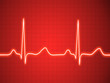 Electrocardiogram, ecg, graph, pulse tracing