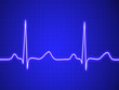Electrocardiogram, ecg, graph, pulse tracing
