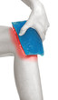 Foto: Cool gel pack on a swollen hurting knee. Cool gel pack on a swollen hurting knee.