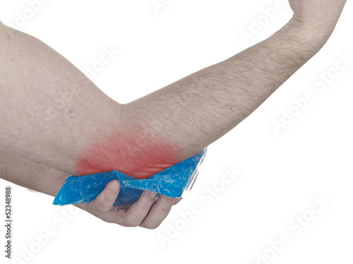 Photo: Cool gel pack on a swollen hurting elbow. Cool gel pack on a swollen hurting elbow.