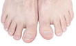 Toes.