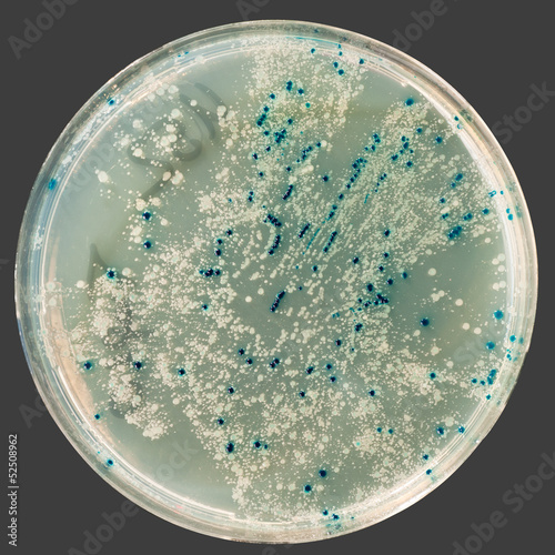 Photo: Bacterial colonies on agar plate Bacterial colonies on agar plate