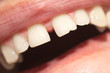 teeth. macro