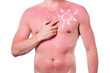 Man with a sunburn