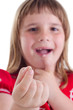 I lose milk tooth