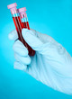 Photo: Test tubes with blood in hand on blue background Test tubes with blood in hand on blue background