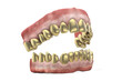 Jaw with golden teeth
