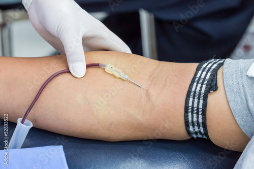 Photo: A large bore needle is inserted for blood donation A large bore needle is inserted for blood donation