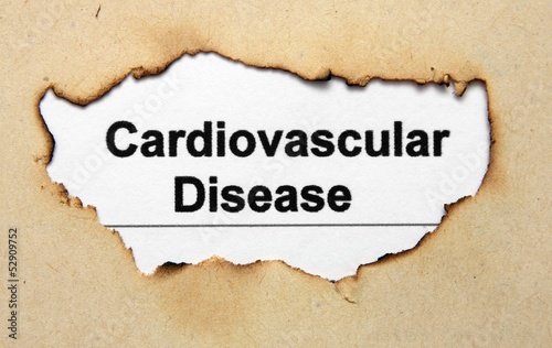 Photo: Cardiovascular disease Cardiovascular disease
