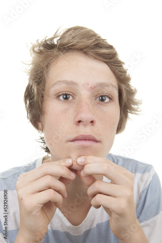 Photo: puberty acne spots puberty acne spots