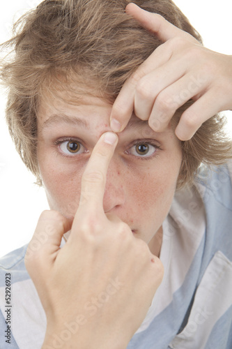 Photo: teen squeezing acne spot teen squeezing acne spot