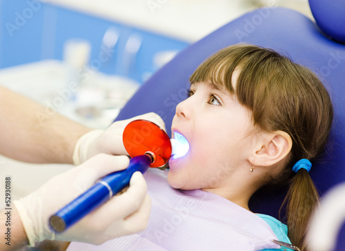 Photo: little girl with open mouth receiving dental filling drying proc little girl with open mouth receiving dental filling drying proc