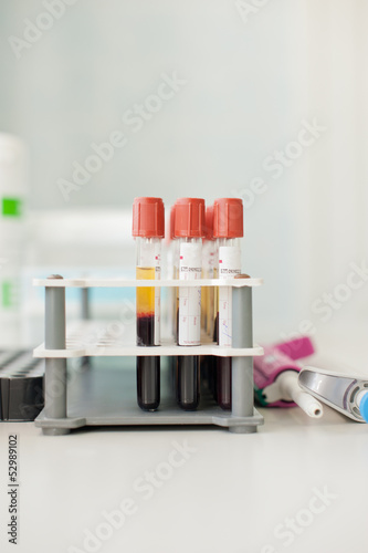 Photo: capsules for the blood analysis capsules for the blood analysis