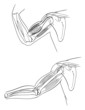 Human arm