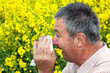 Man with hay fever on blooming rapeseed field