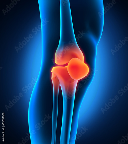 Illustration: Painful Knee Painful Knee