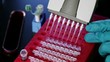 Experiment in the microbiology laboratory