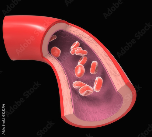Illustration: Arteria coronaria normal Arteria coronaria normal
