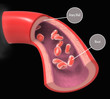 Normal  artery