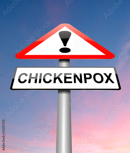 Illustration: Chickenpox concept. Chickenpox concept.