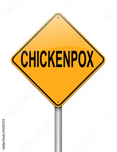 Illustration: Chickenpox concept. Chickenpox concept.