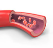 Normal artery