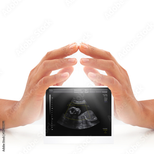 Photo: Woman hands over ultrasound of baby in mother's womb. Pregnancy Woman hands over ultrasound of baby in mother's womb. Pregnancy